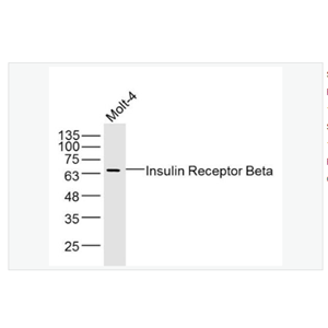 Anti-Insulin Receptor Beta antibody-胰岛素受体β抗体