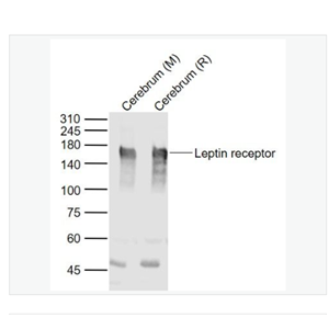 Anti-Leptin receptor antibody-瘦素受体抗体