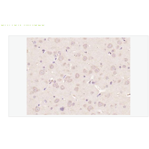 Anti-Nestinantibody-巢蛋白/神经上皮干细胞蛋白抗体