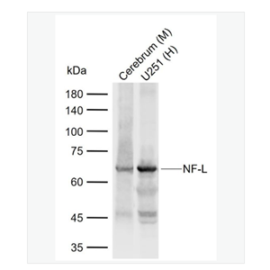 Anti-NF-L  antibody-低分子量神经丝蛋白抗体