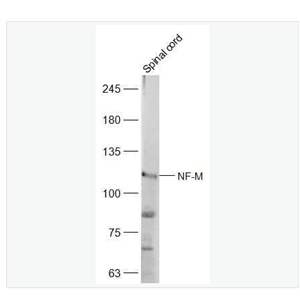Anti-NF-M antibody-中分子量神经丝蛋白抗体