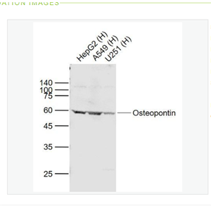 Anti-Osteopontin  antibody-骨桥蛋白/分泌型磷蛋白1抗体