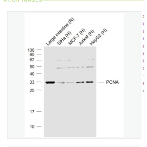 Anti-PCNA (Nuclear Loading Control)  antibody-增殖细胞核抗原（核内参）抗体