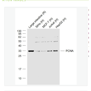 Anti-PCNA (Nuclear Loading Control)  antibody-增殖细胞核抗原（核内参）抗体,PCNA (Nuclear Loading Control)