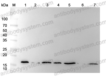 抗Hypusine (Hpu24),Anti-Hypusine antibody (Hpu24)RGK08101