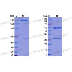 抗体：HPV16 E7/Protein E7 Antibody (Nb27) RVV08904