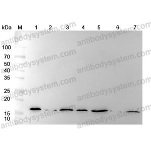 抗Hypusine (Hpu24),Anti-Hypusine antibody (Hpu24)RGK08101
