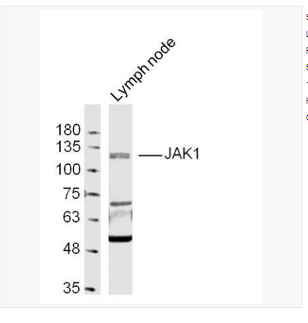 Anti-JAK1 antibody-蛋白质酪氨酸激酶JAK-1抗体,JAK1
