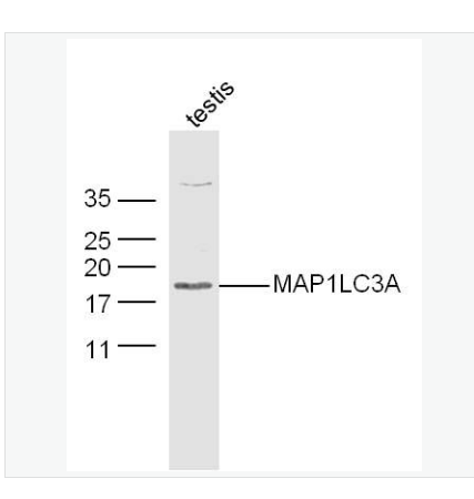 Anti-MAP1LC3A antibody-自噬微管相关蛋白轻链3抗体,MAP1LC3A