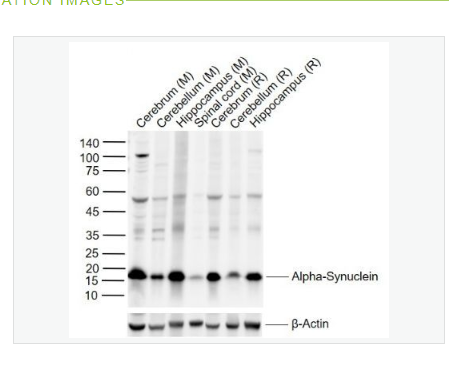 Anti-SNCA  antibody-核突觸蛋白-α（N端）抗體,SNCA