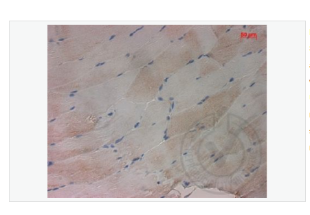 Anti-PALB2 antibody-乳腺癌易感基因相关蛋白2,PALB2