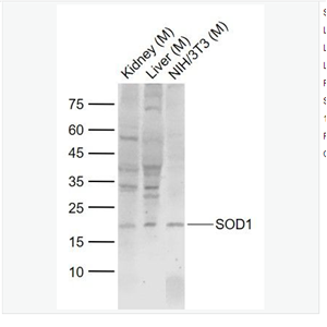 Anti-SOD1 antibody-超氧化物歧化酶1（铜/锌过氧化物歧化酶SOD）抗体,SOD1