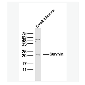 Anti-Survivin antibody-细胞凋亡抑制因子抗体