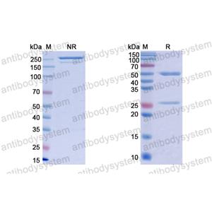 抗体：VSV G/Glycoprotein G Antibody (VI22) RVV09814,G/Glycoprotein G