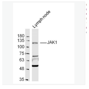 Anti-JAK1 antibody-蛋白质酪氨酸激酶JAK-1抗体