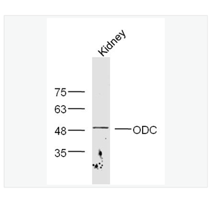 Anti-ODC1 antibody-鸟氨酸脱羧酶抗体
