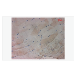 Anti-PALB2 antibody-乳腺癌易感基因相关蛋白2,PALB2