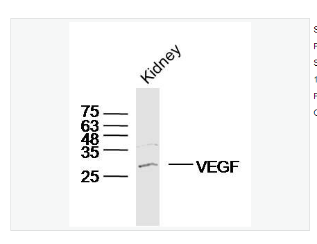 Anti-VEGFA  antibody-血管內(nèi)皮生長因子抗體,VEGFA