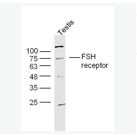 Anti-FSH receptor antibody-促卵泡刺激素受體抗體,FSH receptor