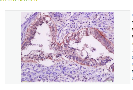 Anti-Mutant p53 antibody- 突變型P53抗體,Mutant p53 (N235K,N239Y)