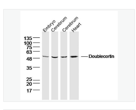 Anti-Doublecortin antibody-双皮质素抗体,Doublecortin