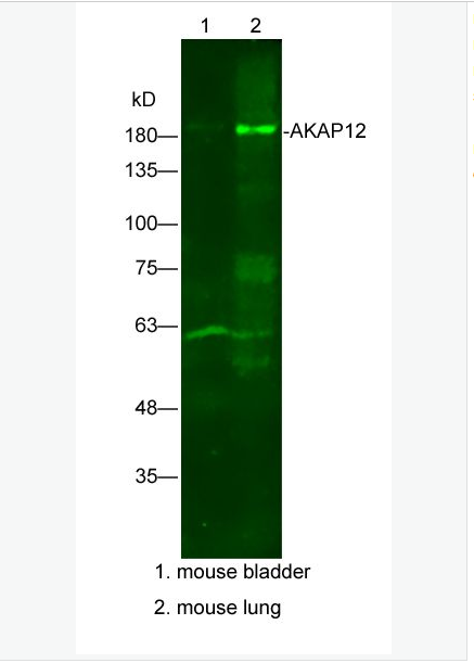 Anti-AKAP12 antibody-絲氨酸抑制蛋白激酶C底物抗體,AKAP12