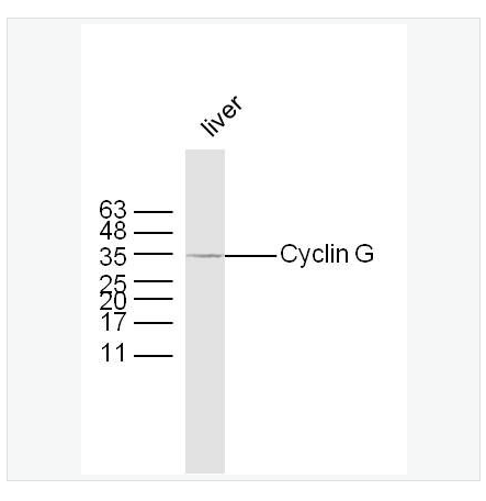 Anti-Cyclin G antibody-周期素G抗体,Cyclin G
