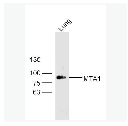 Anti-MTA1 antibody-肿瘤转移相关蛋白1抗体,MTA1
