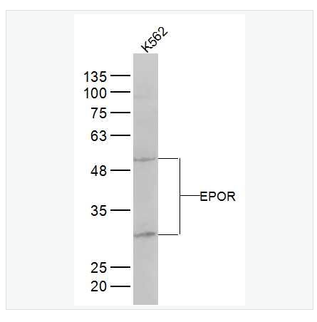 Anti-EPOR  antibody-红细胞生成素受体抗体,EPOR