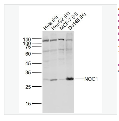 Anti-NQO1  antibody-醌氧化還原酶抗體,NQO1