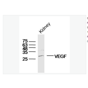 Anti-VEGFA  antibody-血管内皮生长因子抗体