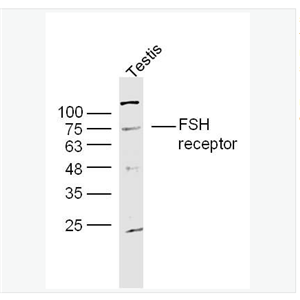 Anti-FSH receptor antibody-促卵泡刺激素受体抗体