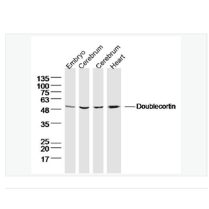 Anti-Doublecortin antibody-双皮质素抗体