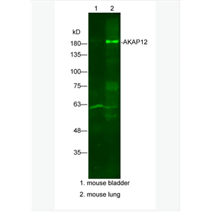 Anti-AKAP12 antibody-丝氨酸抑制蛋白激酶C底物抗体