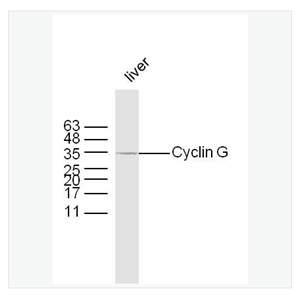Anti-Cyclin G antibody-周期素G抗体,Cyclin G