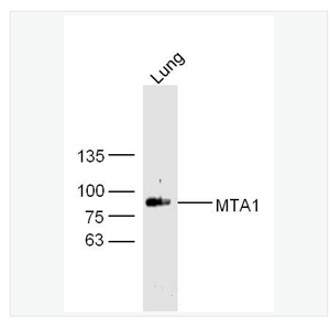 Anti-MTA1 antibody-肿瘤转移相关蛋白1抗体