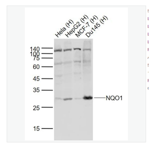 Anti-NQO1  antibody-醌氧化还原酶抗体