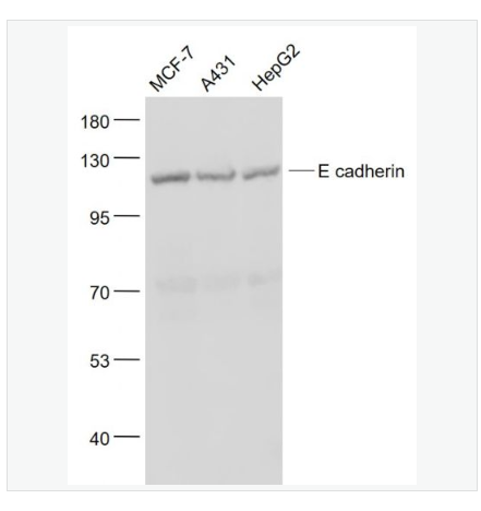 Anti-E cadherin antibody-上皮钙粘附分子抗体,E cadherin