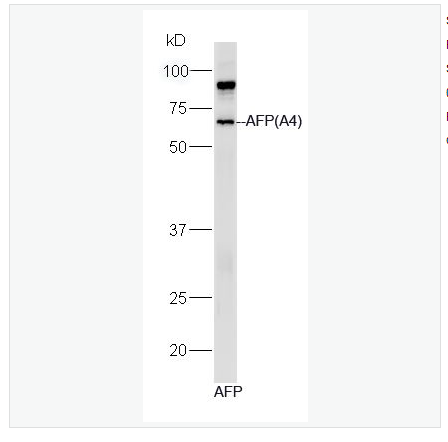 Anti-AFP(A2 antibody-甲胎蛋白單克隆抗體（包被）,AFP(A2)