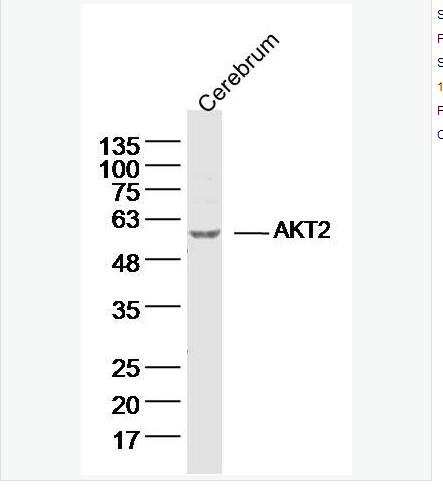 Anti-AKT2 antibody-蛋白激酶B2抗体,AKT2