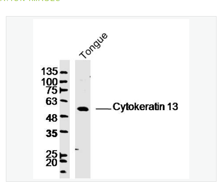 Anti-Cytokeratin 13 antibody-细胞角蛋白13抗体,Cytokeratin 13