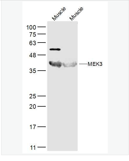 Anti-MEK3  antibody-丝裂原活化蛋白激酶MKK3抗体,MEK3