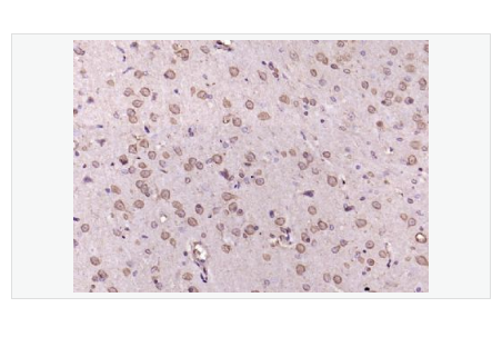 Anti-phospho-Erk1 antibody-磷酸化丝裂原活化蛋白激酶1抗体,phospho-Erk1 (Thr202 + Tyr204)