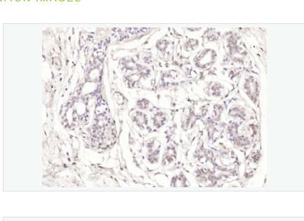 Anti-Phospho-Estrogen Receptor alpha antibody-磷磷酸化雌激素受体ER alpha 抗体,Phospho-Estrogen Receptor alpha (Ser167)