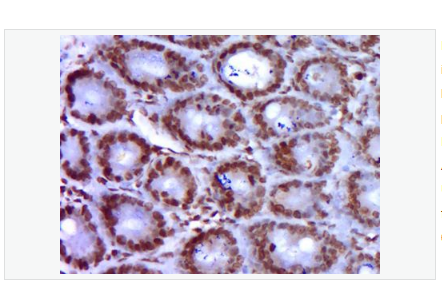 Anti-GATA5 antibody-GATA结合蛋白5抗体,GATA5