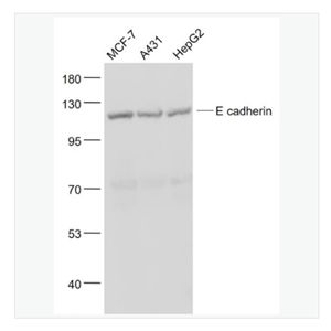 Anti-E cadherin antibody-上皮钙粘附分子抗体,E cadherin