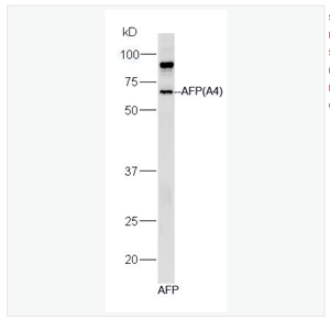 Anti-AFP(A2 antibody-甲胎蛋白单克隆抗体（包被）