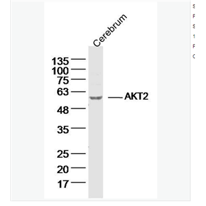 Anti-AKT2 antibody-蛋白激酶B2抗体