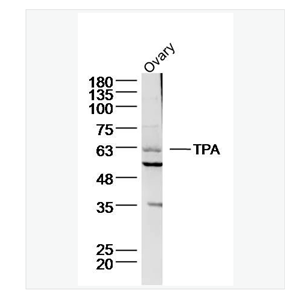 Anti-TPA  antibody-组织型纤溶酶原激活剂抗体,TPA