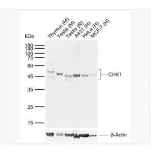 Anti-CHK1 antibody-细胞周期检测点激酶1抗体,CHK1